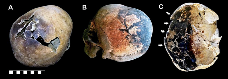 Illustration for article titled Cuando un volcán vaporiza la sangre y hace explotar el cerebro: la espantosa muerte de las víctimas del Vesubio
